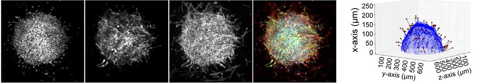 spheroid invasion assay